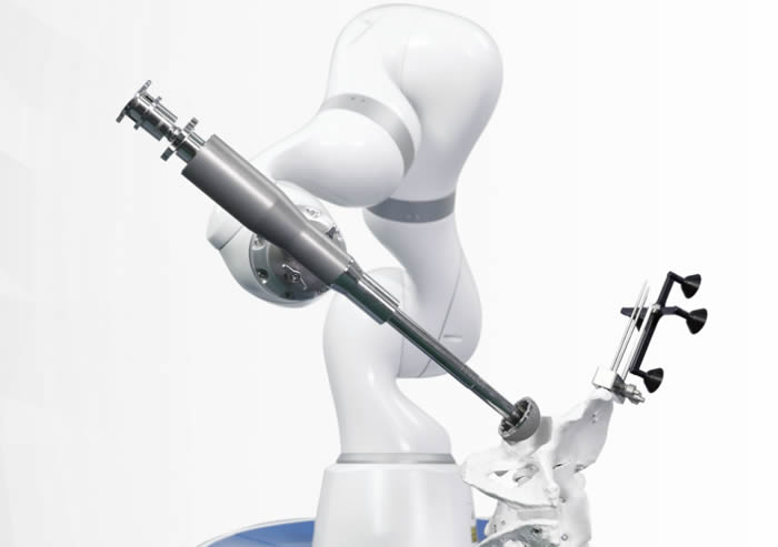 ȫyP(gun)(ji)ÓQg(sh)CARTHROBOT